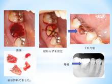 めざせHC  0